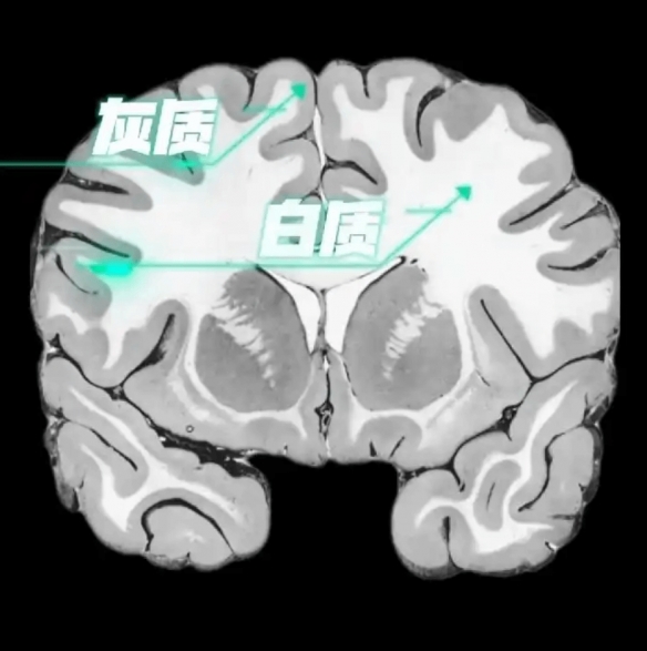 不必为年龄焦虑!研究称中国人大脑发育约38岁才到巅峰(图2) 不必为年龄焦虑!研究称中国人大脑发育约38岁才到巅峰(图2)